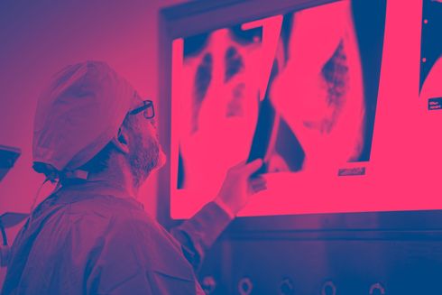 Doctor checking x rays